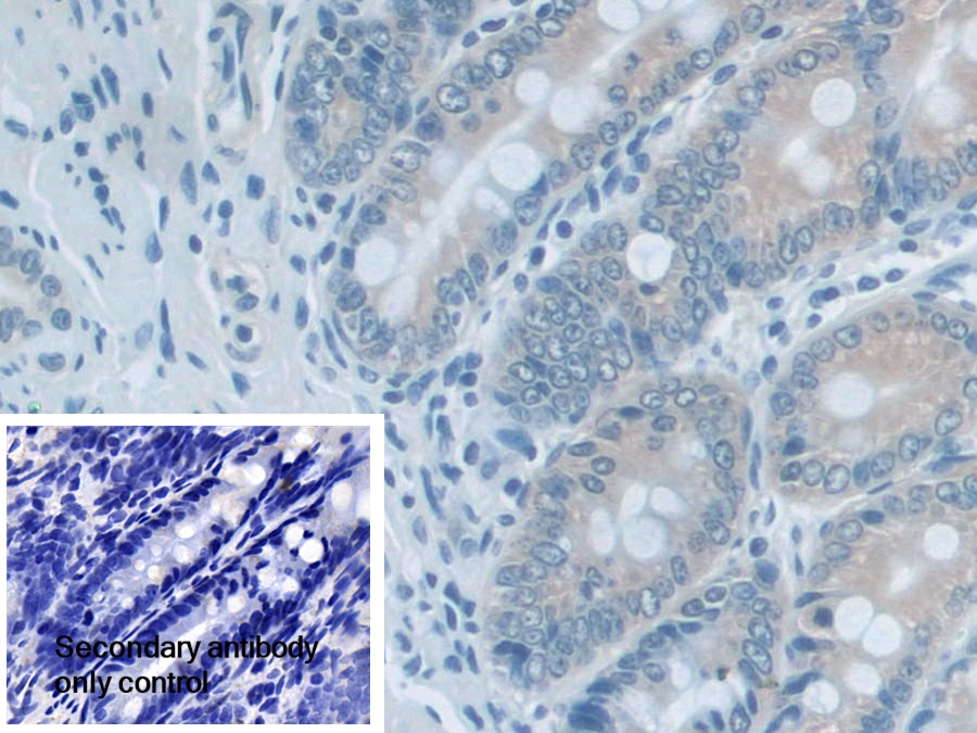 Polyclonal Antibody to Adenylate Kinase 2 (AK2)