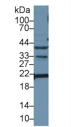 Polyclonal Antibody to Apolipoprotein M (APOM)