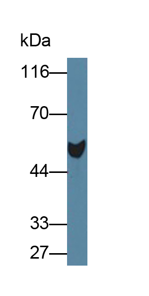 Polyclonal Antibody to Antithrombin (AT)