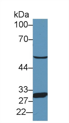 Polyclonal Antibody to Antithrombin (AT)