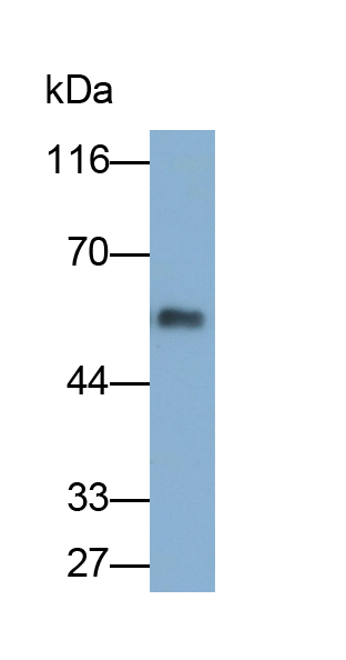 Polyclonal Antibody to Antithrombin (AT)