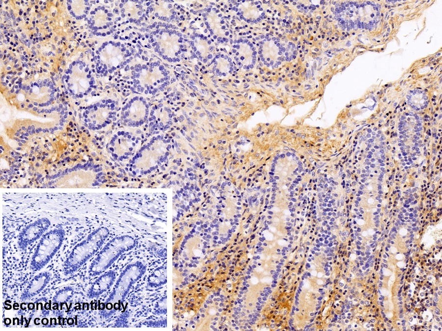 Polyclonal Antibody to Antithrombin (AT)