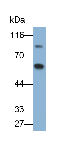 Polyclonal Antibody to Antithrombin (AT)