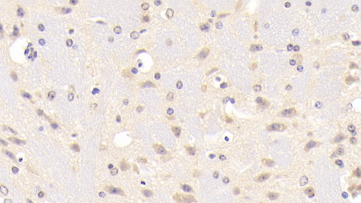 Polyclonal Antibody to B-Cell CLL/Lymphoma 10 (Bcl10)