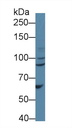Polyclonal Antibody to Bcl6 Corepressor (BCOR)
