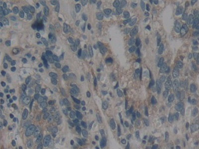 Polyclonal Antibody to Bcl2 Modifying Factor (BMF)