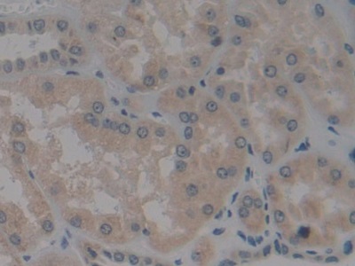 Polyclonal Antibody to Bcl2 Modifying Factor (BMF)