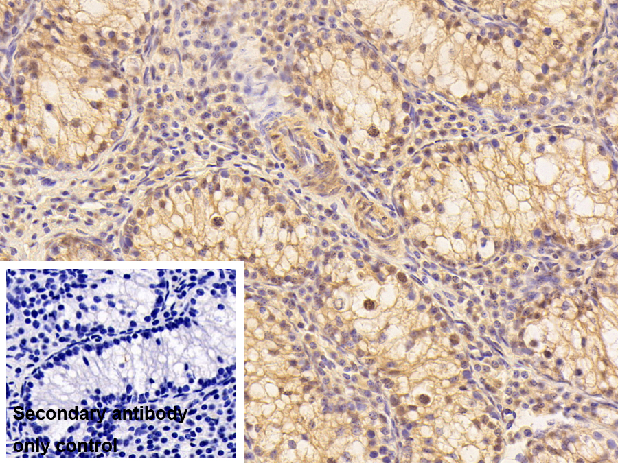 Polyclonal Antibody to Bcl2 Associated Athanogene 3 (BAG3)
