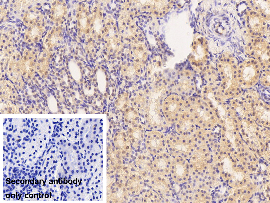 Polyclonal Antibody to Bcl2 Associated Athanogene 3 (BAG3)