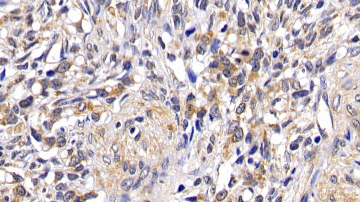 Polyclonal Antibody to Bcl2 Associated Death Promoter (BAD)