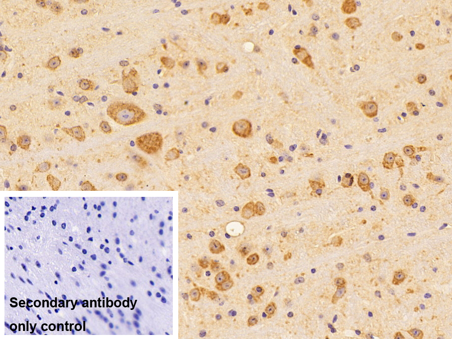 Polyclonal Antibody to Heat Shock 70kDa Protein 5 (HSPA5)