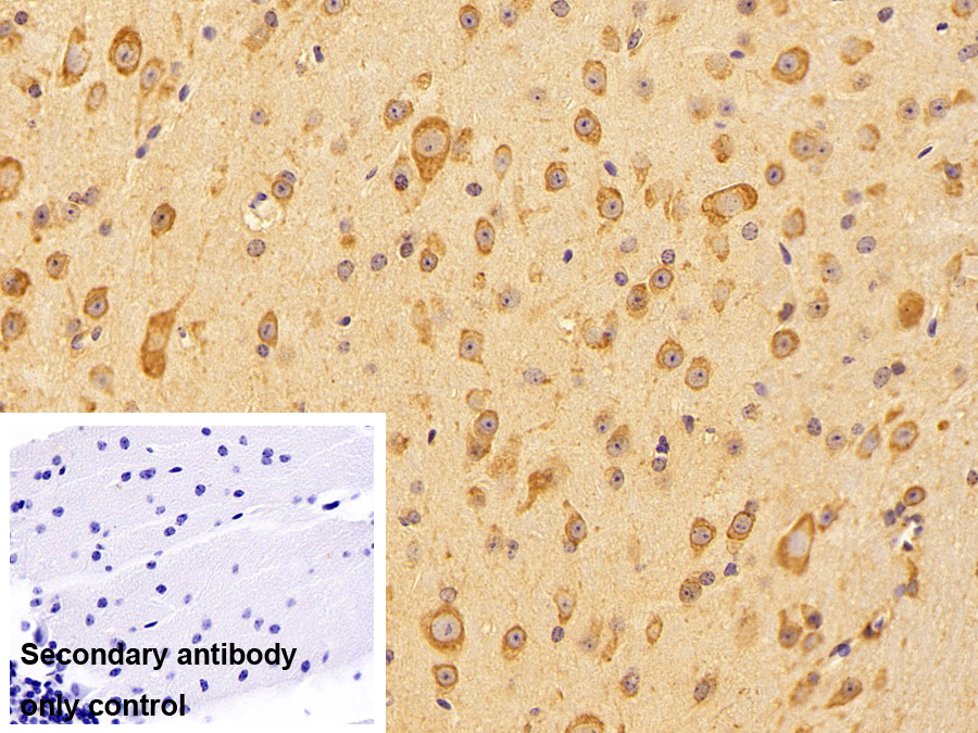 Polyclonal Antibody to Heat Shock 70kDa Protein 5 (HSPA5)