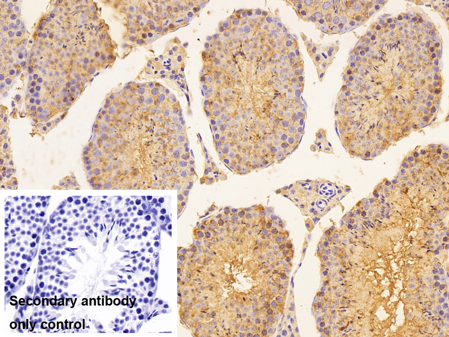 Polyclonal Antibody to Heat Shock 70kDa Protein 5 (HSPA5)