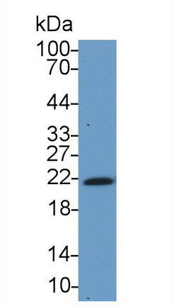 Polyclonal Antibody to Chromobox Homolog 3 (CBX3)