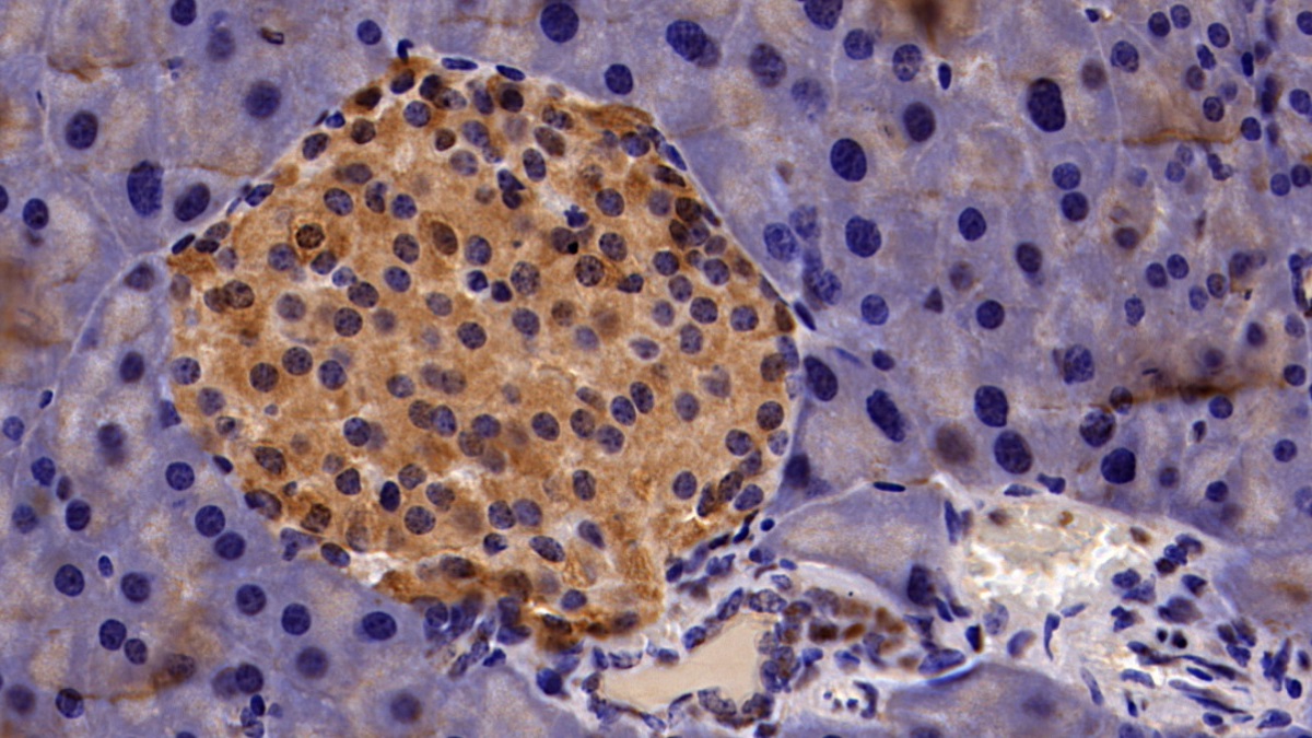 Polyclonal Antibody to Chromobox Homolog 3 (CBX3)