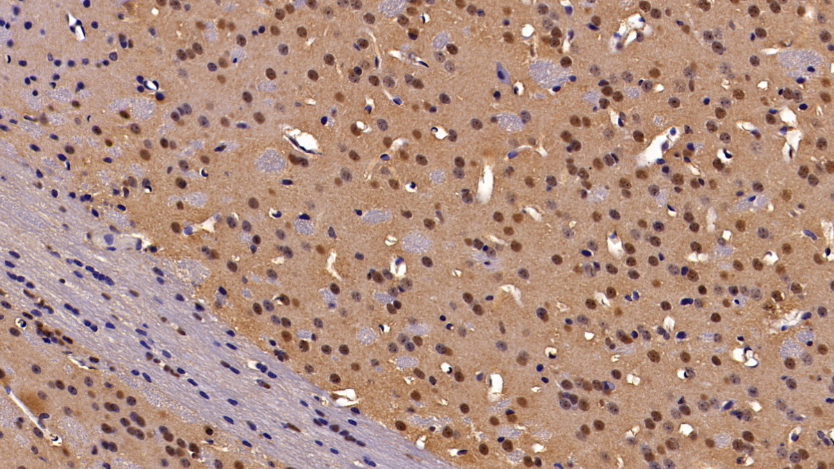 Polyclonal Antibody to Chromobox Homolog 3 (CBX3)