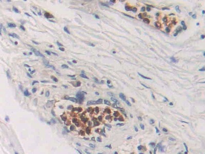 Polyclonal Antibody to Cytidine Deaminase (CDA)