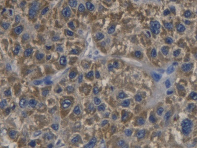 Polyclonal Antibody to Cyclin Dependent Kinase Inhibitor 3 (CDKN3)