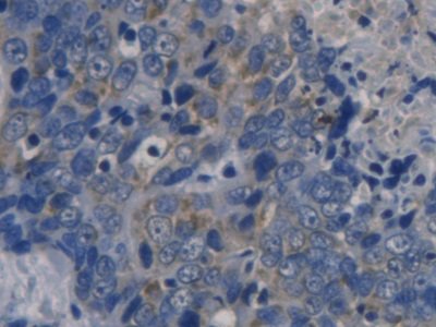 Polyclonal Antibody to Cyclin Dependent Kinase Inhibitor 3 (CDKN3)