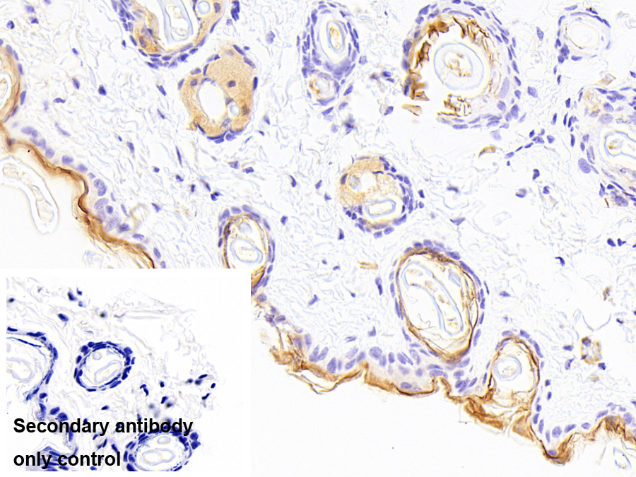 Polyclonal Antibody to Corneodesmosin (CDSN)
