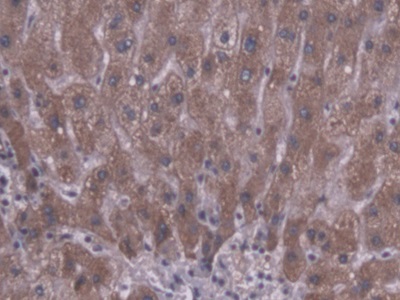 Polyclonal Antibody to Carboxylesterase 1 (CES1)