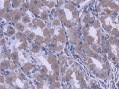 Polyclonal Antibody to Carboxylesterase 1 (CES1)