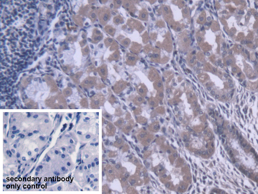 Polyclonal Antibody to Carboxylesterase 1 (CES1)