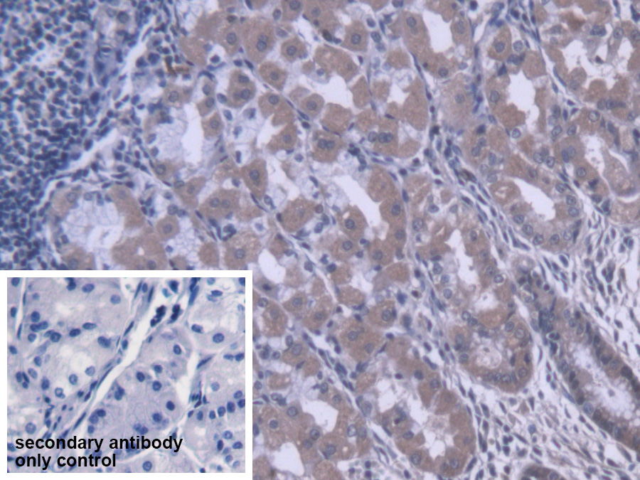 Polyclonal Antibody to Carboxylesterase 1 (CES1)