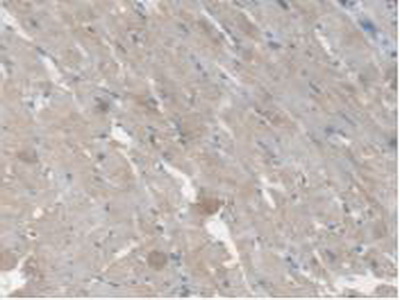 Polyclonal Antibody to Carboxylesterase 1 (CES1)
