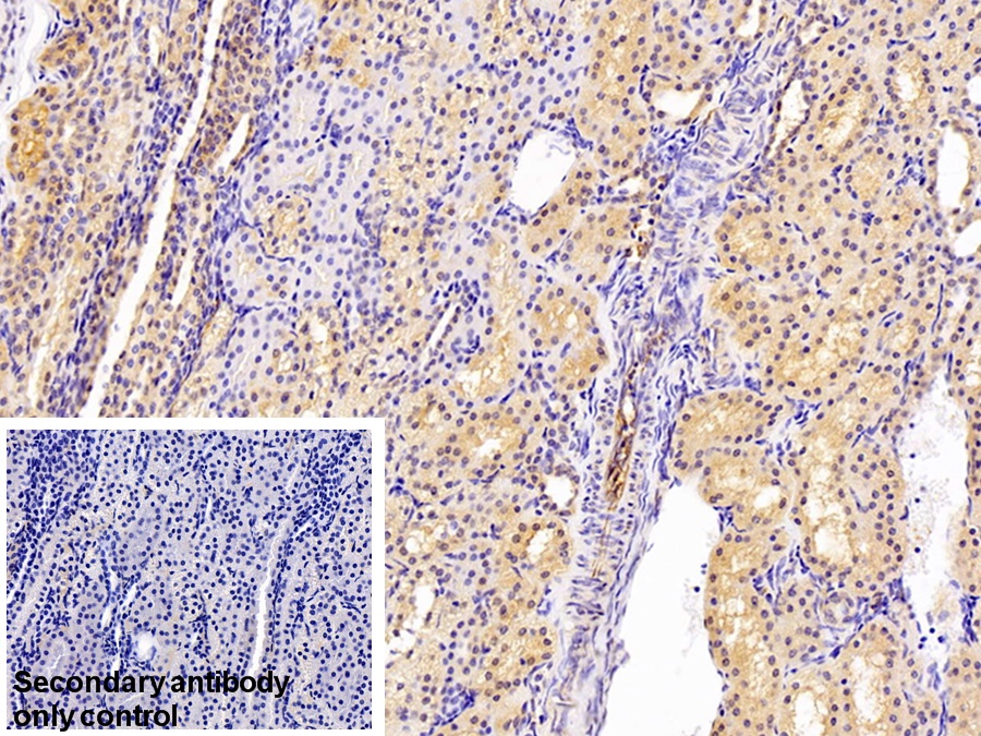 Polyclonal Antibody to Chloride Intracellular Channel Protein 1 (CLIC1)