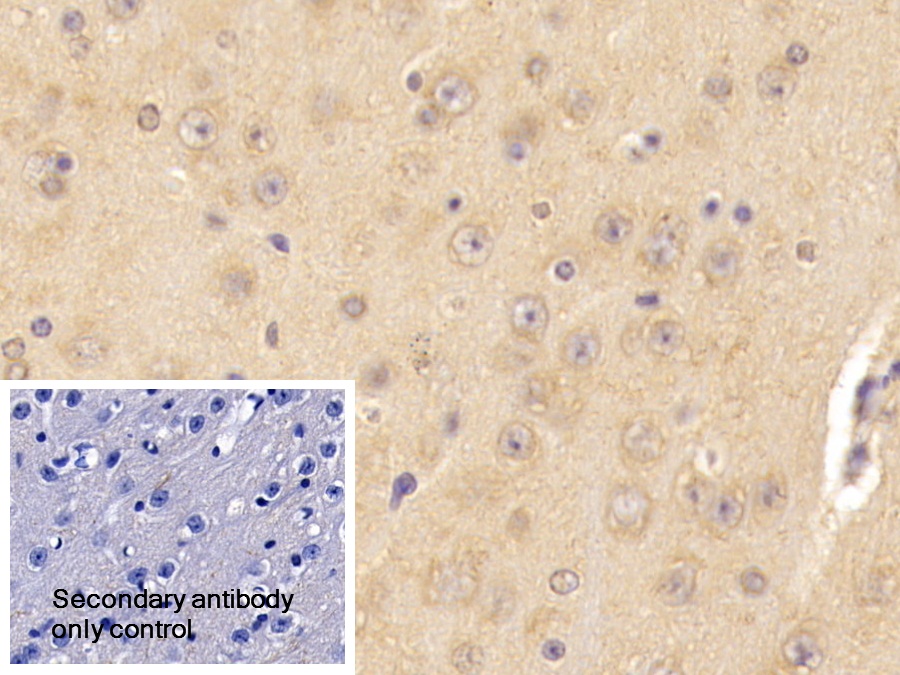 Polyclonal Antibody to Carnitine-O-Octanoyltransferase (CORT)