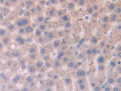Polyclonal Antibody to Cubilin (CUBN)