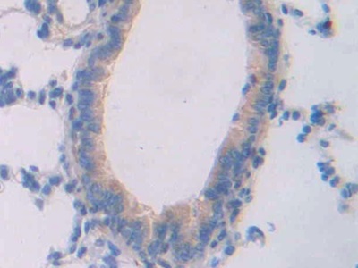 Polyclonal Antibody to Cubilin (CUBN)