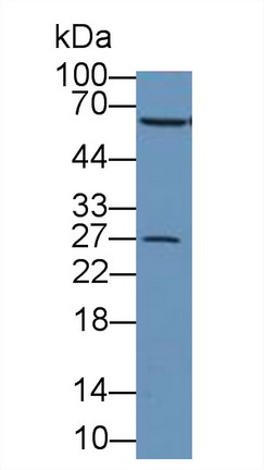 Polyclonal Antibody to Catalase (CAT)