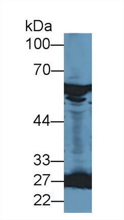 Polyclonal Antibody to Catalase (CAT)