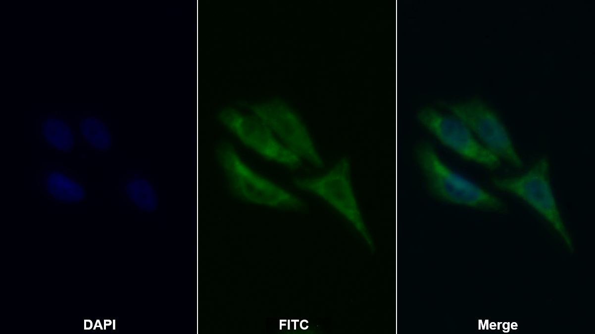 Polyclonal Antibody to Catalase (CAT)