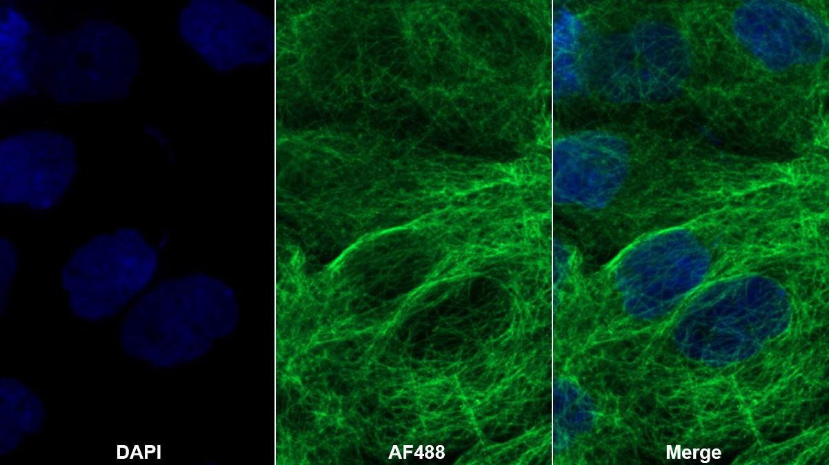 Polyclonal Antibody to Cylindromatosis (CYLD)