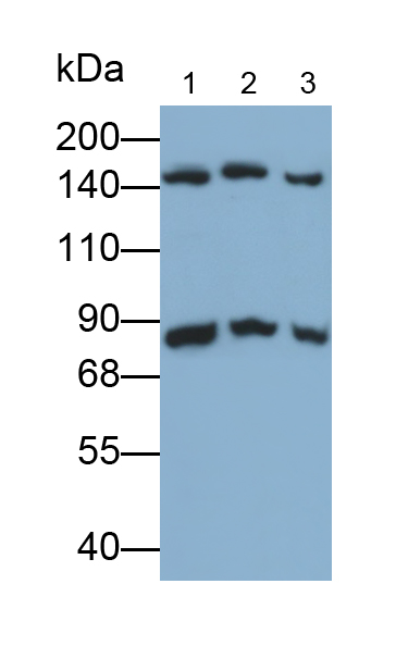 Polyclonal Antibody to Cystic Fibrosis Transmembrane Conductance Regulator (CFTR)