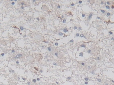 Polyclonal Antibody to Drebrin 1 (DBN1)