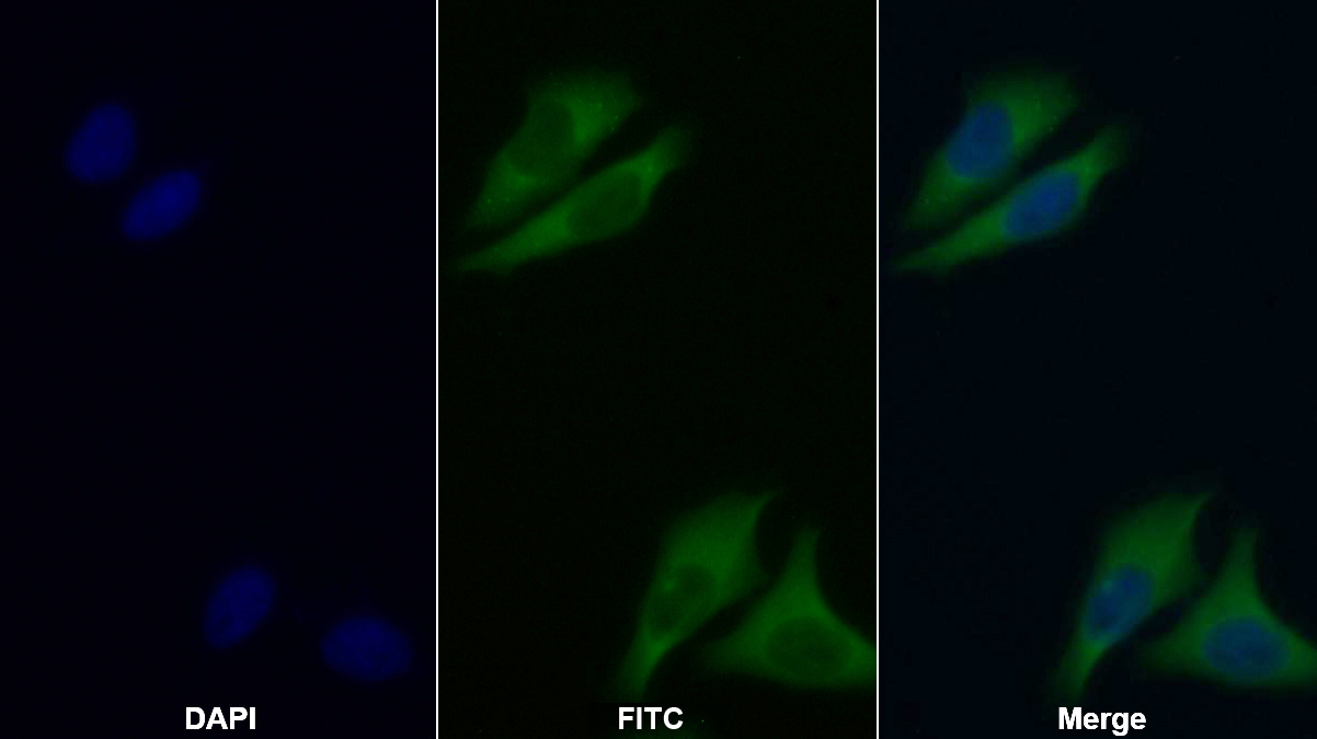 Polyclonal Antibody to Dystrobrevin Binding Protein 1 (DTNBP1)