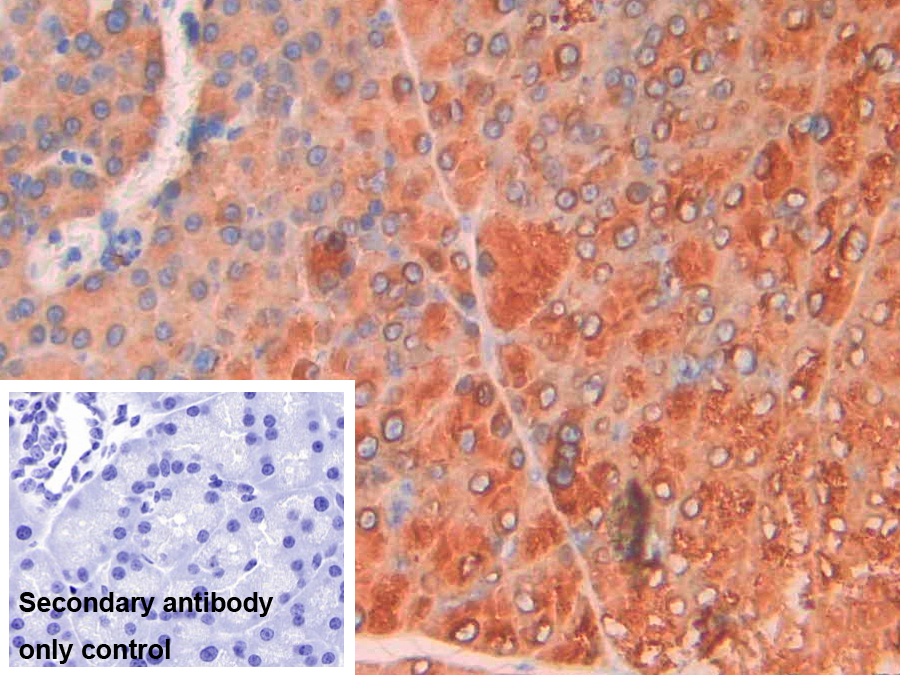 Polyclonal Antibody to Epithelial Cell Transforming Sequence 2 (ECT2)