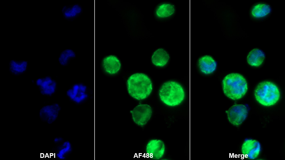 Polyclonal Antibody to Endoplasmic Reticulum To Nucleus Signalling 1 (ERN1)