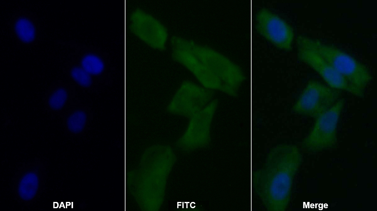 Polyclonal Antibody to Endoplasmic Reticulum Protein 29 (ERP29)
