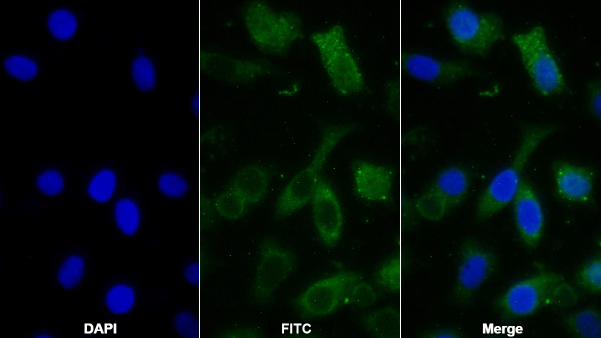 Polyclonal Antibody to Fibroblast Activation Protein Alpha (FAPa)