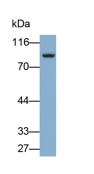 Polyclonal Antibody to Fibulin 1 (FBLN1)