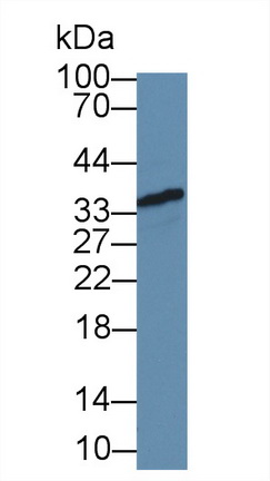 Polyclonal Antibody to Fibrillarin (FBL)