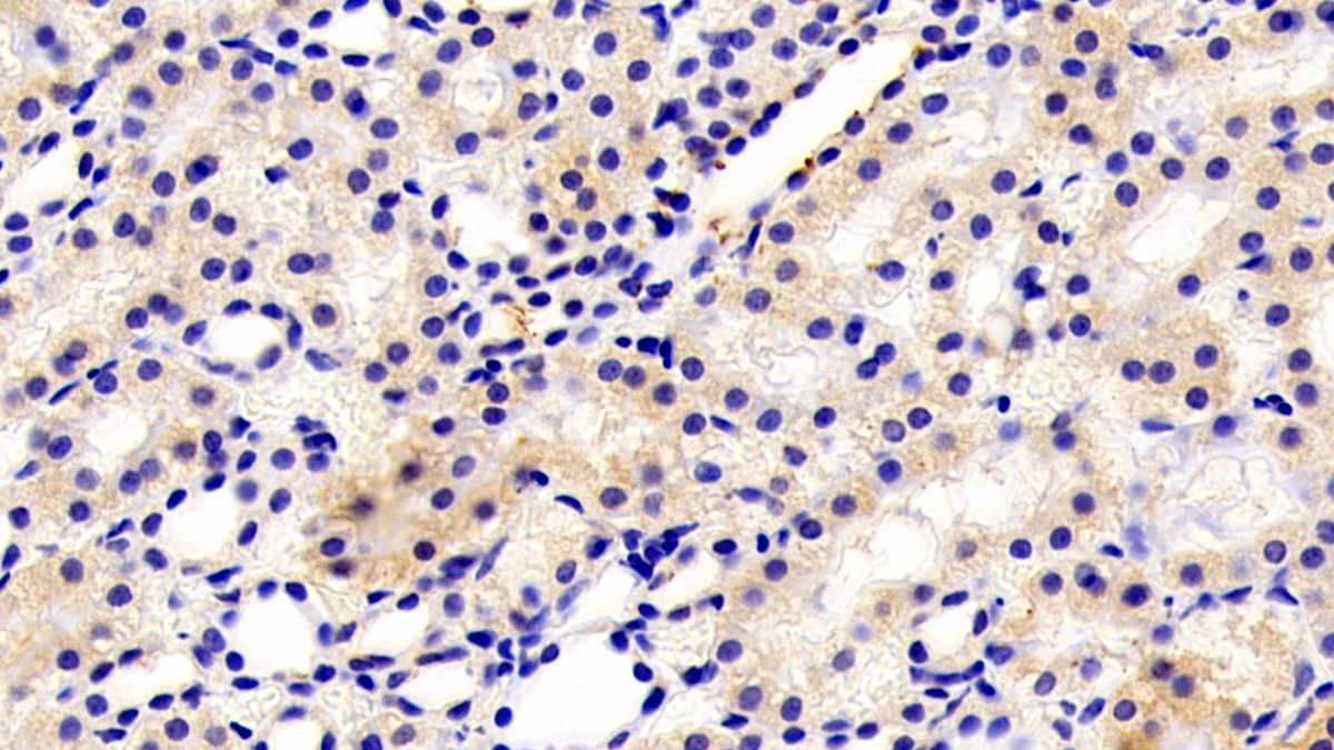 Polyclonal Antibody to Fibrillarin (FBL)