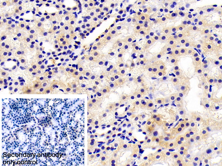 Polyclonal Antibody to Fibrillarin (FBL)