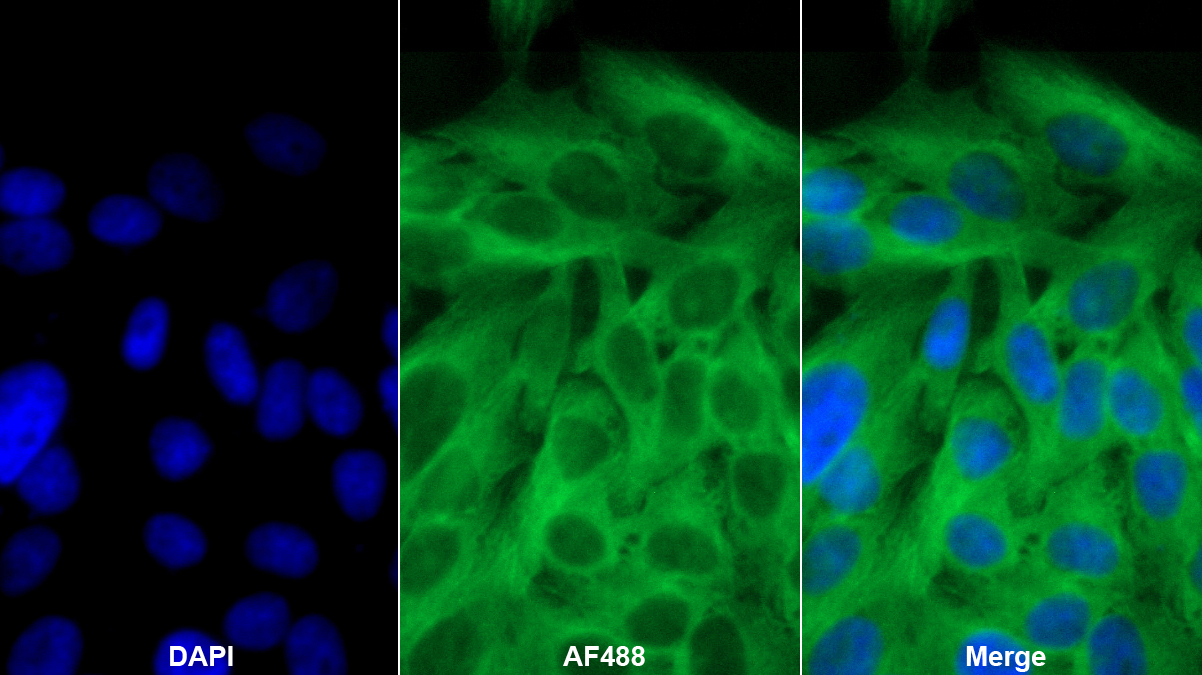 Polyclonal Antibody to Furin (FUR)