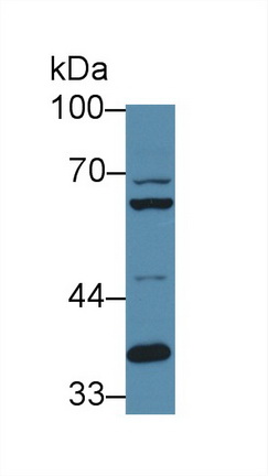 Polyclonal Antibody to Furin (FUR)